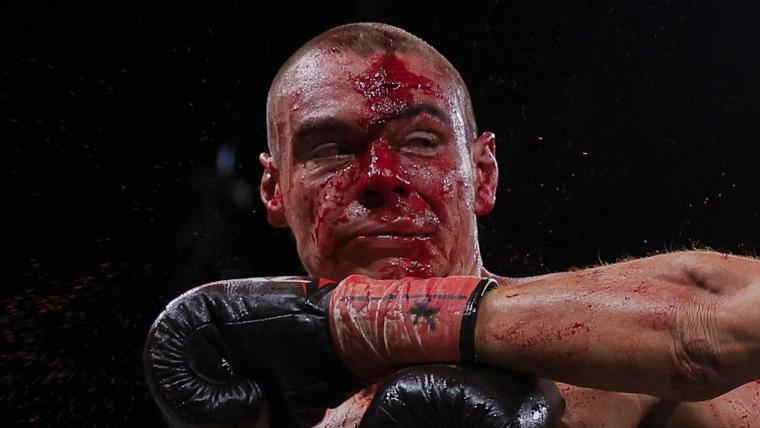 Should Tszyu vs. Fundora fight have been stopped? Australian boxer loses world title in bloodbath image