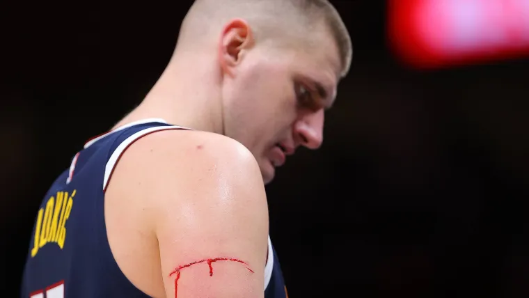 Nikola Jokic's arm scratch