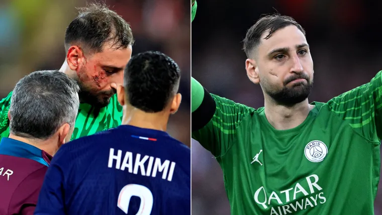 Gianluigi Donnarumma of PSG face injury split